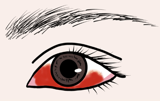 白目が赤くなっているイメージ画像