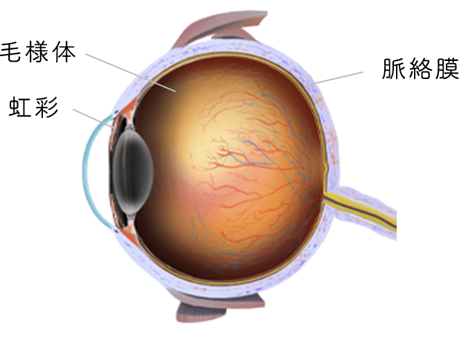 ぶどう膜炎のイメージ画像