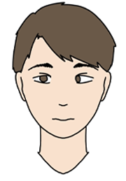 斜視のイメージ画像