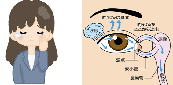 流涙症のイメージ画像